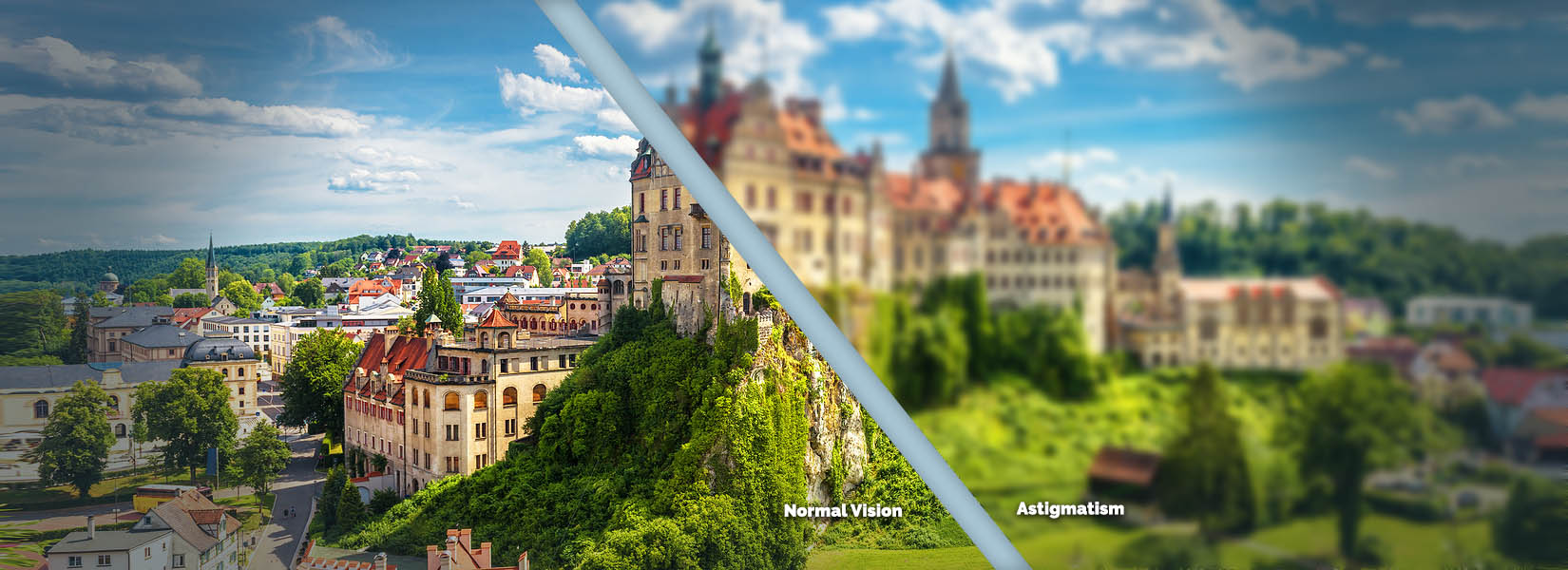 Astigmatism Treatment in St. Louis
