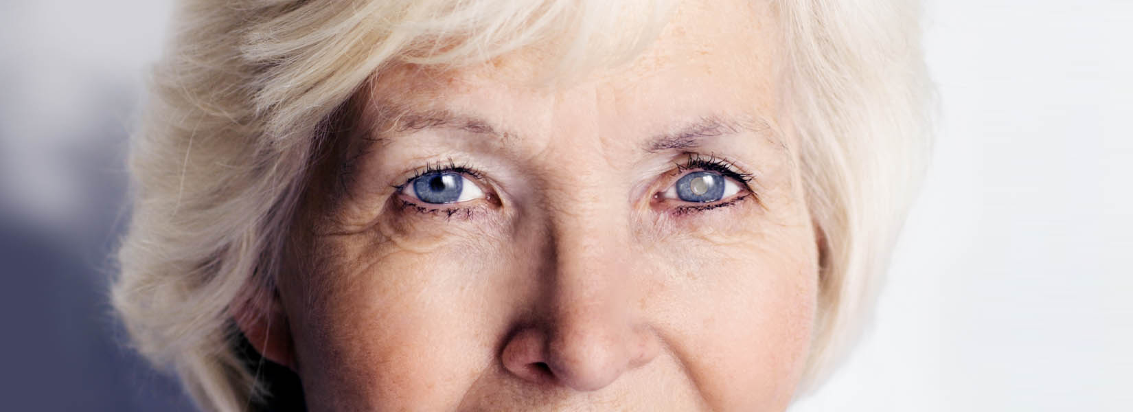 Cataract Surgery in St. Louis